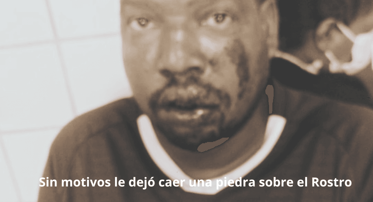 ¡Ojo, un loco anda suelto en Apartadó!  Agredió a Pedradas a “Nacho” y a un hombre de Chigorodó que hacía vueltas en Apartadó