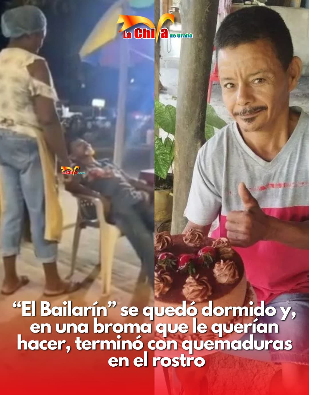 “El Bailarín” resultó con quemaduras en el rostro tras broma que salió mal en Carepa